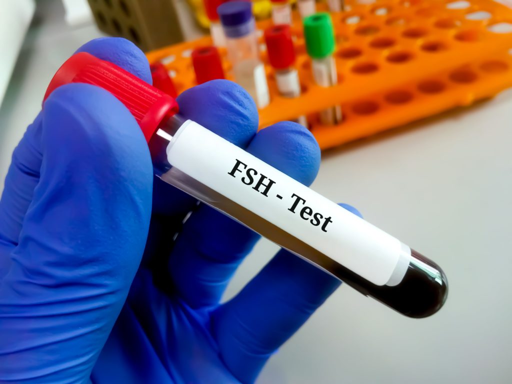 Test de hormona FSH