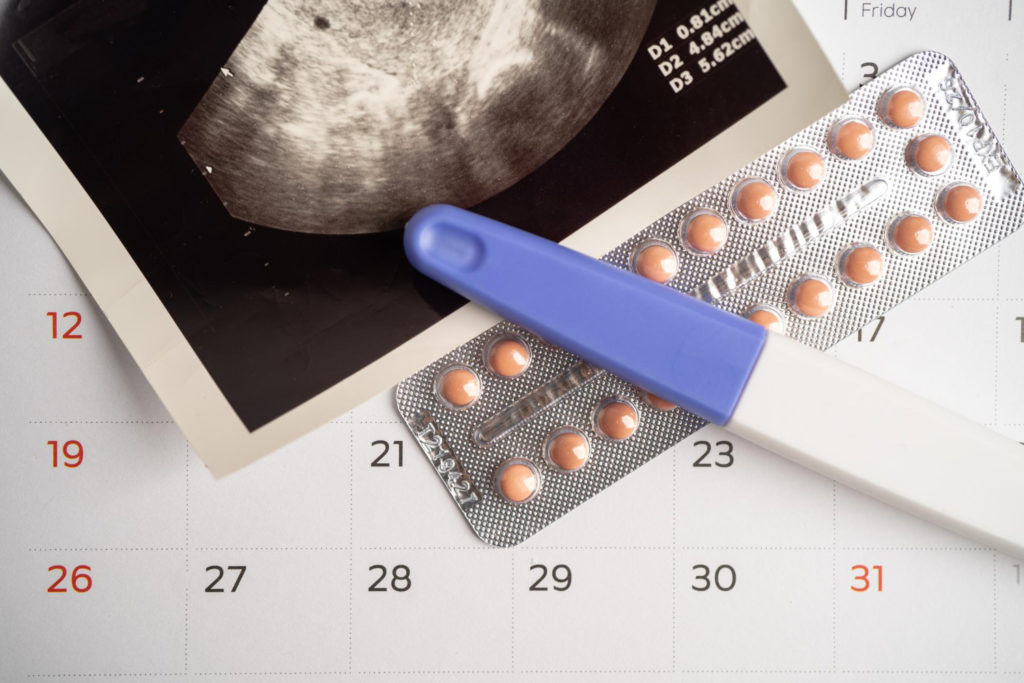 Ecografía, calendario, test de embarazado y pastillas de utrogestan en una mesa