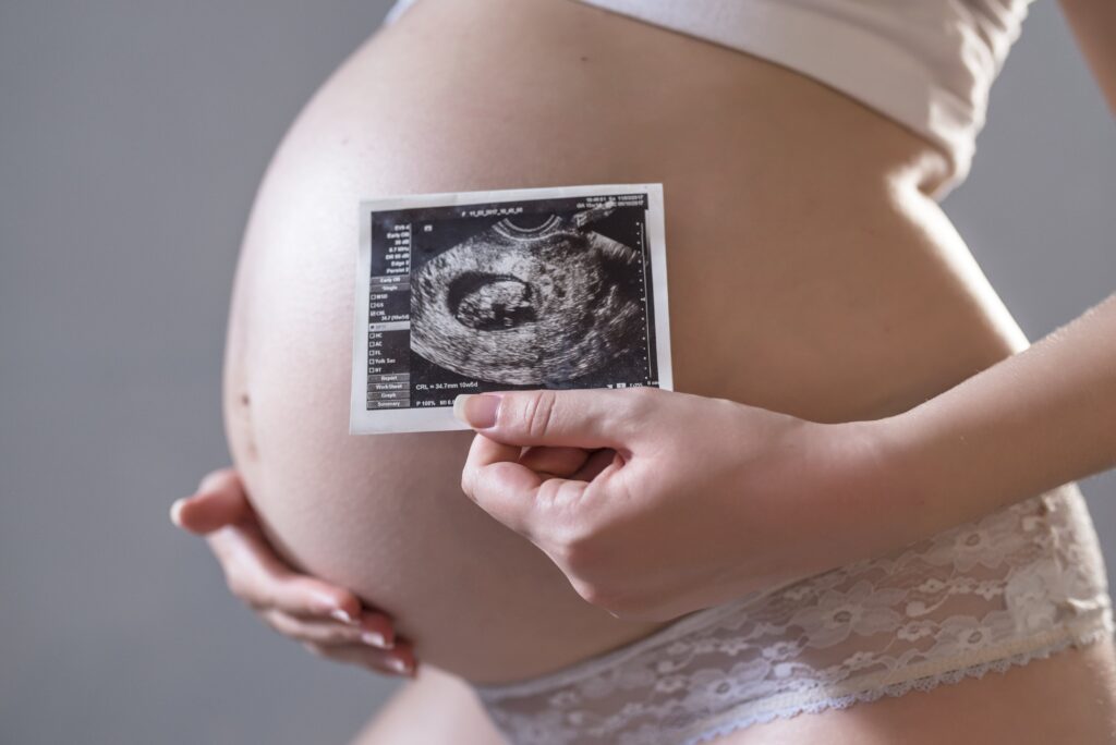 pregnant-woman-holding-x-ray-front-her-belly-high-min Tipos de ecografía