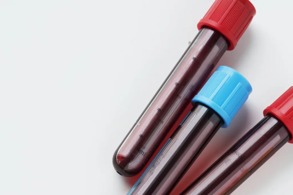 closeup-blood-tube-test-min Prolactina valores normales