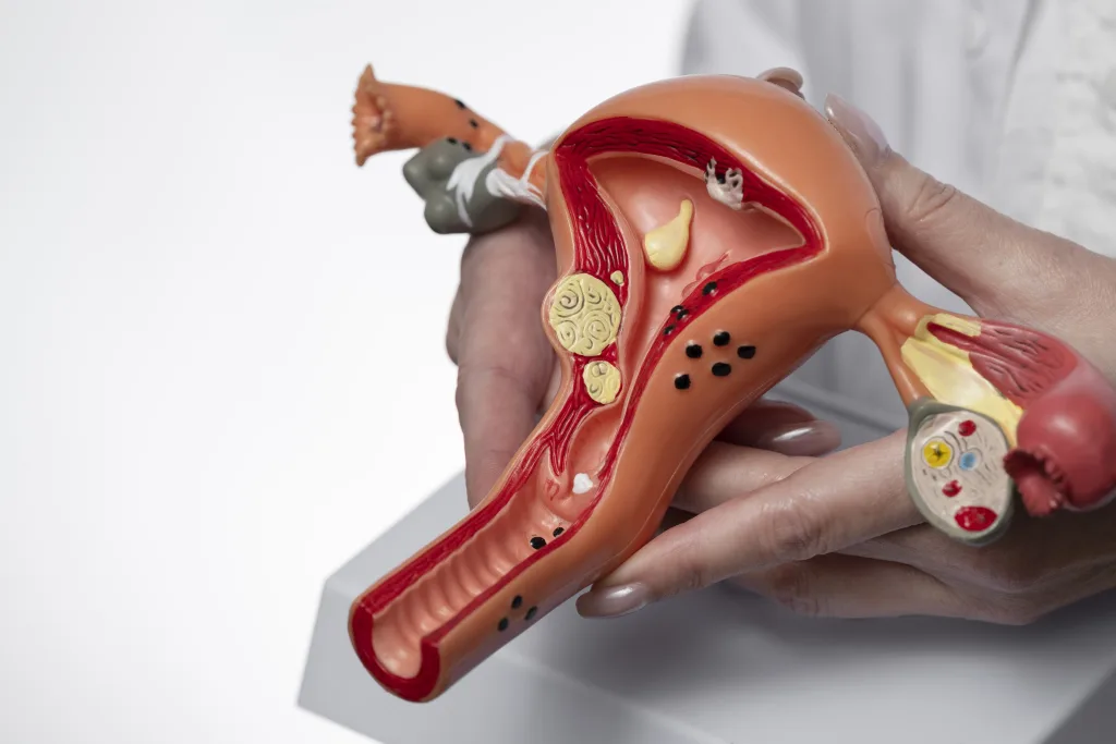 hand-holding-uterus-ovary-model-min Útero