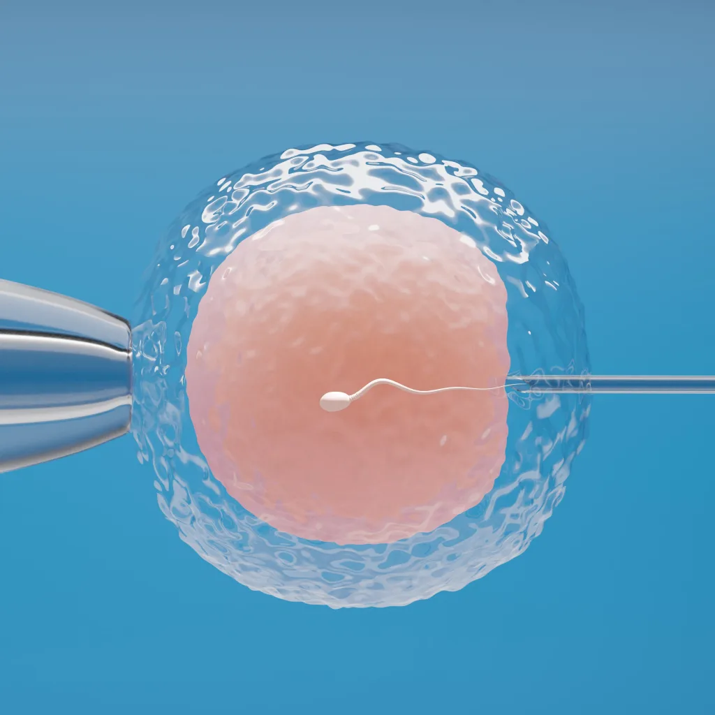 Inseminación artificial para madres solteras
