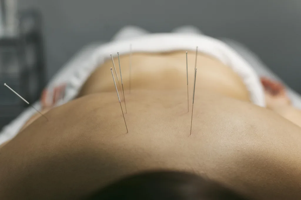 acupuncture-process-client-min Acupuntura y fertilidad