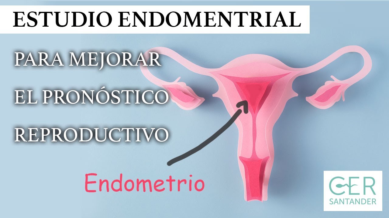 Biopsia Endometrial Todo Lo Que Necesitas Saber Cer Santander